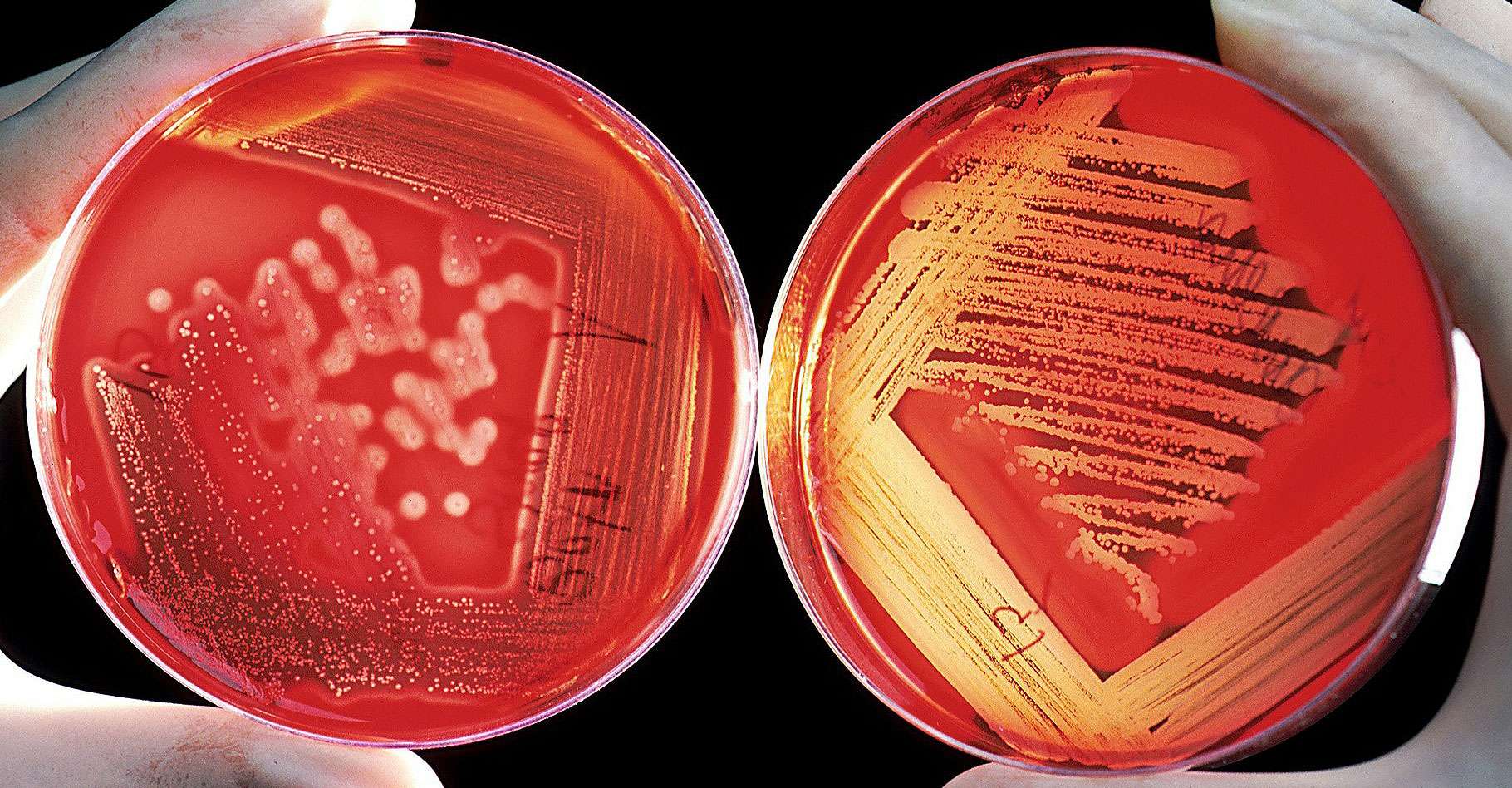 Que Sont La Listeria Et La Salmonellose Dossier