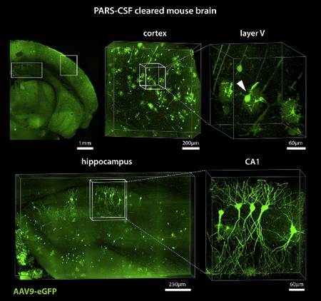 Le procédé permet de rendre visibles, au sein de leur organe et sans endommager leur interconnexion, des cellules nerveuses ou des vaisseaux sanguins, comme ici, dans ces images agrandies du cortex et de l'hippocampe du cerveau, et de simplifier leur étude in situ. © Yang et al., Cell Le procédé permet de rendre visibles, au sein de leur organe et sans endommager leur interconnexion, des cellules nerveuses ou des vaisseaux sanguins, comme ici, dans ces images agrandies du cortex et de l'hippocampe du cerveau, et de simplifier leur étude in situ. © Yang et al., Cell