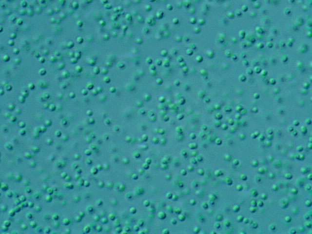 Ces cyanobactéries Prochlorococcus marinus sont extrêmement abondantes dans les régions tropicales et tempérées chaudes de l'océan ouvert. Certains scientifiques affirment qu'il est l'organisme le plus abondant sur Terre. Il serait responsable de près de 50 % de la fixation du carbone dans les océans. © Bob Andersen, D. J. Patterson