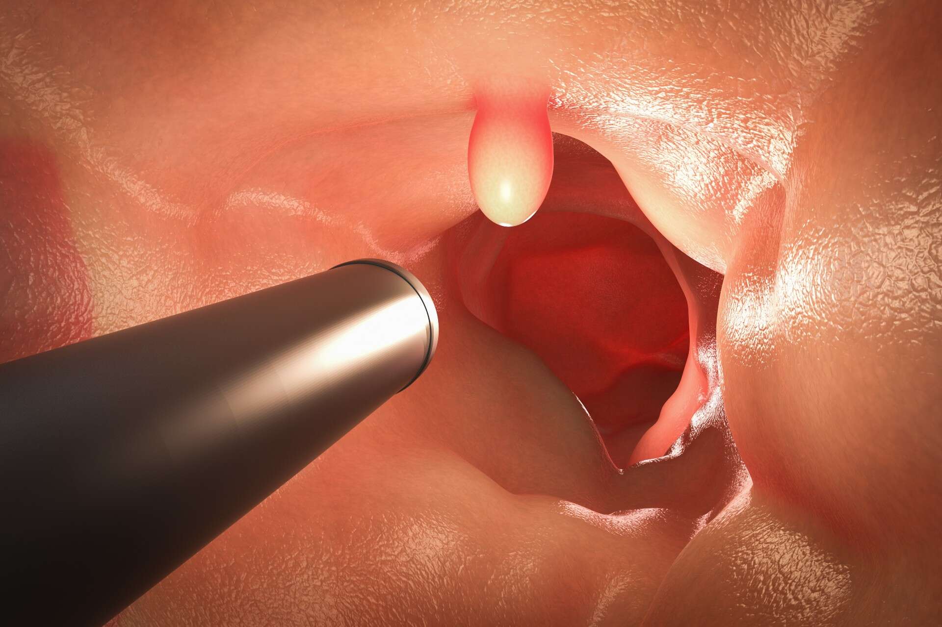 A study finds that colonoscopy does not reduce the risk of death from colorectal cancer