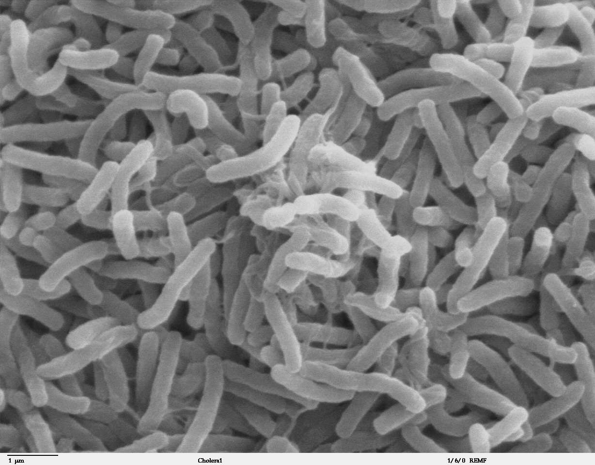 Vibrio cholerae, la bactérie responsable du choléra, n'est plus adaptée pour s'en prendre à certains Bangladais dotés de mutations génétiques qui les préservent de la maladie. © Zeimusu, Wikipédia, DP