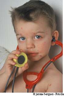 Varicelle : en vaccinant, vous protègerez toute la famille ! La varicelle peut être dangereuse pour les adultes. La vaccination divise les risques par neuf. © Jérôme Berquez/Fotolia