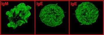 Allergie : pour l'éviter, des cellules immunitaires se font « hara-kiri » Lymphocytes B visualisés en microscopie confocale (x 1.000). Le cytosquelette (molécules d’actine) est marqué par une sonde fluorescente verte (phalloïdine FITC). Les lymphocytes B avec une IgM à leur surface ont des protubérances (pseudopodes) témoignant de leur mobilité alors que les lymphocytes B IgE+ perdent ces structures et deviennent immobiles. © CNRS, laboratoire « Contrôle de la réponse immune B et lymphoproliférations »