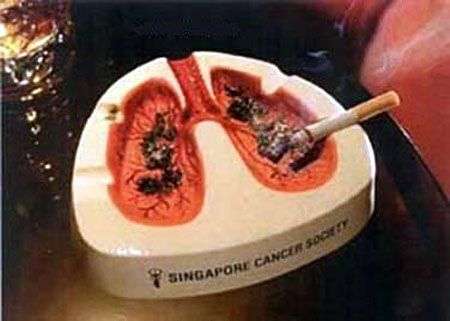 Cancer du fumeur. Source Commons