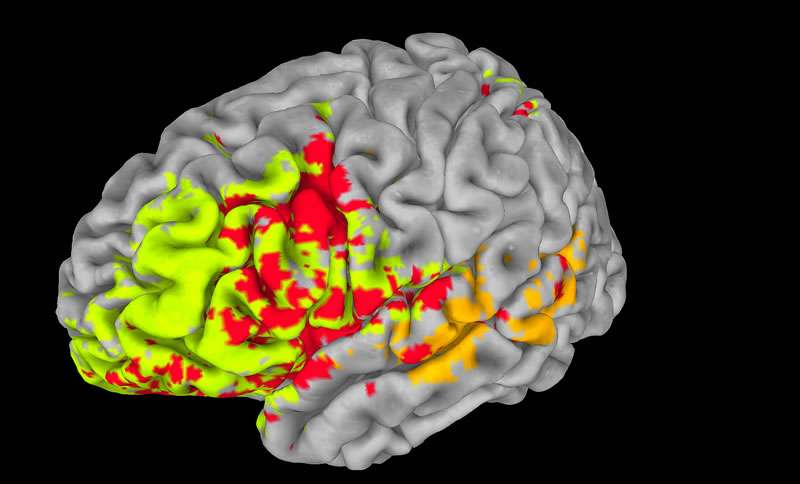 Enfin un atlas de l'intelligence dans le cerveau humain