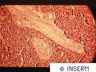 Un premier traitement du diabète de type 1 PANCREAS DE RAT BB DIABETIQUE. UN VAISSEAU.(crédit : INSERM)