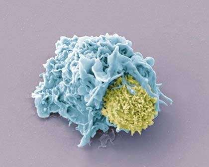 Contact entre un lymphocyte, en jaune, et une cellule présentatrice de l'antigène (cellule dendritique), en bleu. Ce contact peut mener à la création d'une synapse immunologique.© Olivier Schwartz/Institut Pasteur