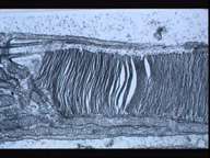Optimisation de la chirurgie corrective grâce aux militaires Crédits : INSERM 97OEIL HUMAIN. RETINE, BATONNETS EN MICROSCOPIE ELECTRONIQUE A TRANSMISSION. x20000.