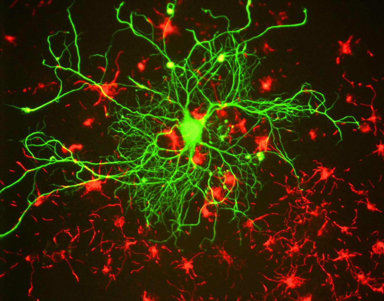 Les neurones transportent les informations via un signal bioélectrique appelé influx nerveux. Le cerveau d'un humain posséderait approximativement 100 milliards de neurones, soit environ 14 fois plus que le nombre d'êtres humains sur Terre. L’implantation de neurones issus de cellules de peau dans le cerveau est l’une des pistes de traitement des maladies dégénératives. © Gerry Shaw, Wikimedia Commons, cc by sa 3.0