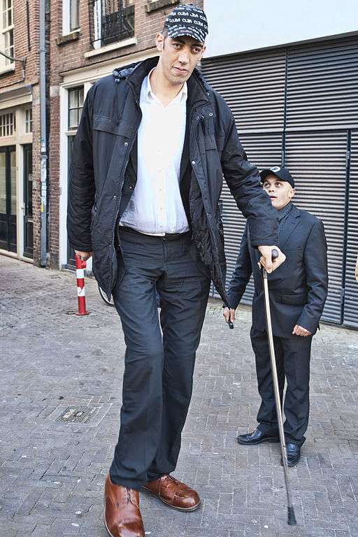 Definition Gigantisme Futura Sante