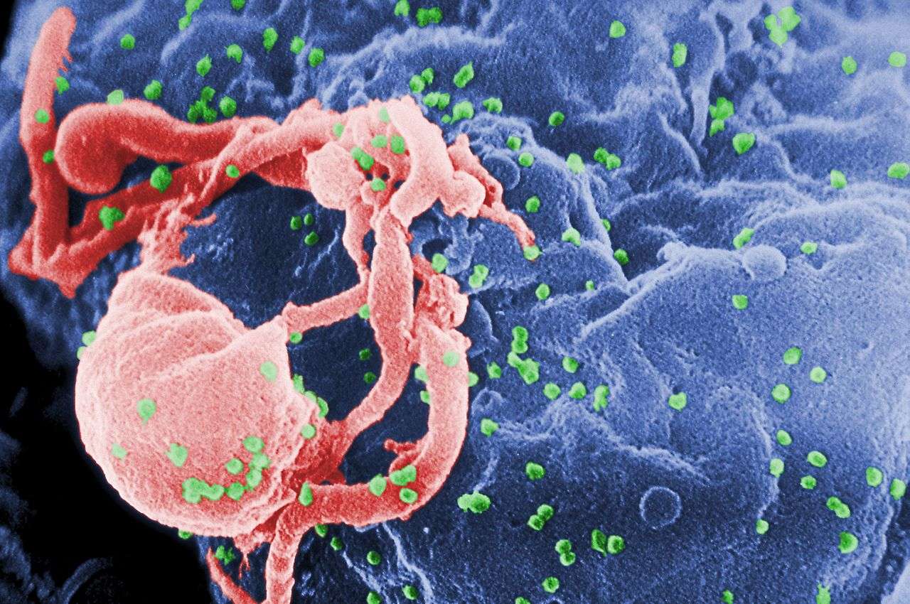 Les particules de VIH, qui apparaissent ici en vert sous microscopie à balayage électronique, s'attaquent aux lymphocytes T4, des cellules fondamentales du système immunitaire. À terme, ce sont toutes les cellules immunitaires qui en pâtissent, le patient déclenche alors le Sida et devient sensible à toute infection. Il faut donc dépister au plus tôt le VIH, et le test salivaire pourrait permettre un dépistage à plus grande échelle par sa simplicité d'utilisation. © C. Goldsmith, Wikipédia, DP
