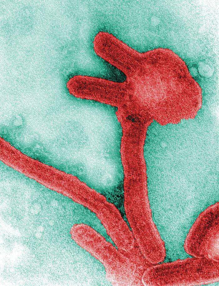 Connaissez-vous bien le virus de Marburg ? Certes il est peu commun... mais terriblement mortel ! © Frederick Murphy, CDC, DP