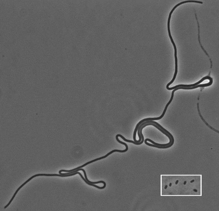 Deux chercheurs de l’université Concordia à Montréal ont observé une bactérie E. coli qui ne se divise pas mais qui continue néanmoins de vivre normalement. © Ziad El-Hajj