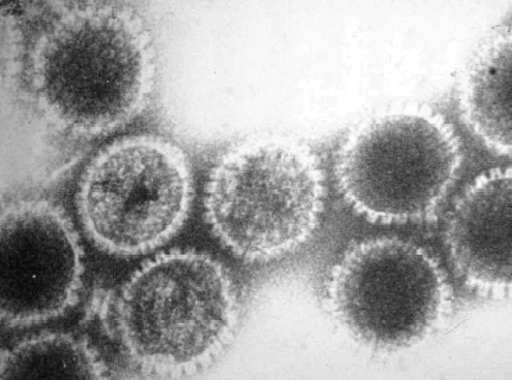 Des virus de l’herpés observés en microscopie électronique. Ce virus appartient à la famille des adénovirus qui contiennent de l'ADN double brin. © George W. Beran, Wikimedia Commons, cc by sa 3.0