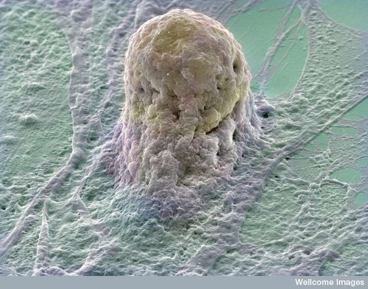 Les cellules souches embryonnaires humaines créées par clonage pourraient intégrer des protocoles de thérapie cellulaire si elles s'avèrent sans danger. © Annie Cavanagh, Wellcome Images, Flickr, cc by nc nd 2.0