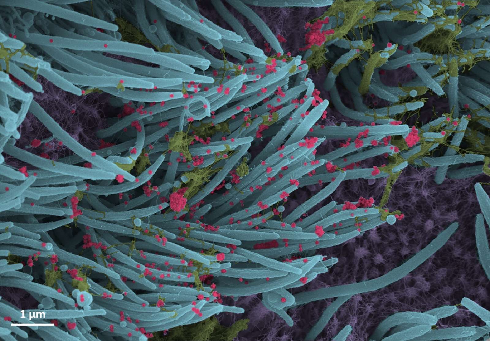 Les virions du SARS-CoV-2 (en rouge) observés au microscope à balayage électronique. © Ehre Lab, UNC School of Medicine
