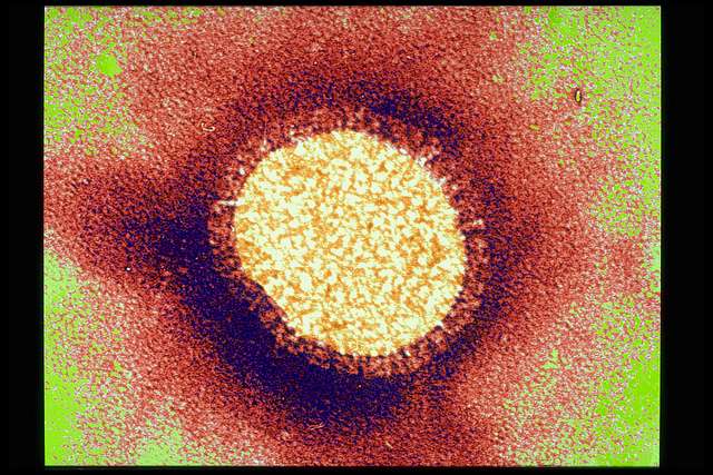 Les virus grippaux de type H1, H2 et H3 sont courants chez l'Homme et sont responsables de la grippe saisonnière. Les formes H5, H7, H9 et H10 ont déjà été observées dans des situations épidémiques. C'est la première fois que l'on constate une grippe H6N1 chez un homme, qui, en l'occurrence, est une femme. © Sanofi Pasteur, Flickr, cc by nc nd 2.0