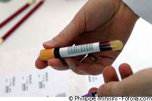 Le test d'urgence du VIH/Sida a été autorisé par un arrêté du Ministère de la Santé. © Philippe Minisini / Fotolia.com