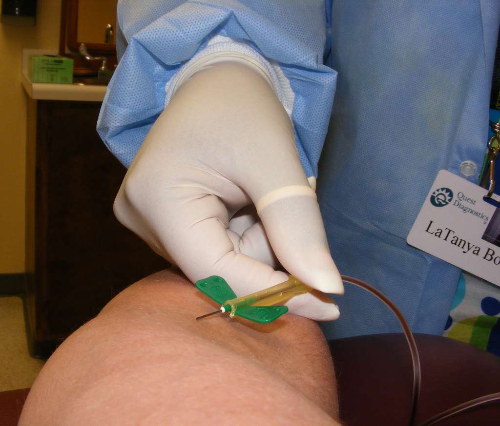 Il faut faire une prise de sang pour détecter le taux de potassium dans le sang. S'il est au-delà de 5 mmol/L, c'est l'hyperkaliémie. © Newbitrh35, Flickr, cc by nc 2.0
