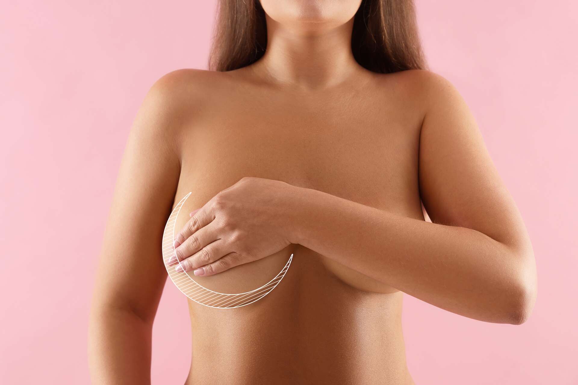 Regarder la vidéo Cette innovation pourrait révolutionner la reconstruction mammaire !