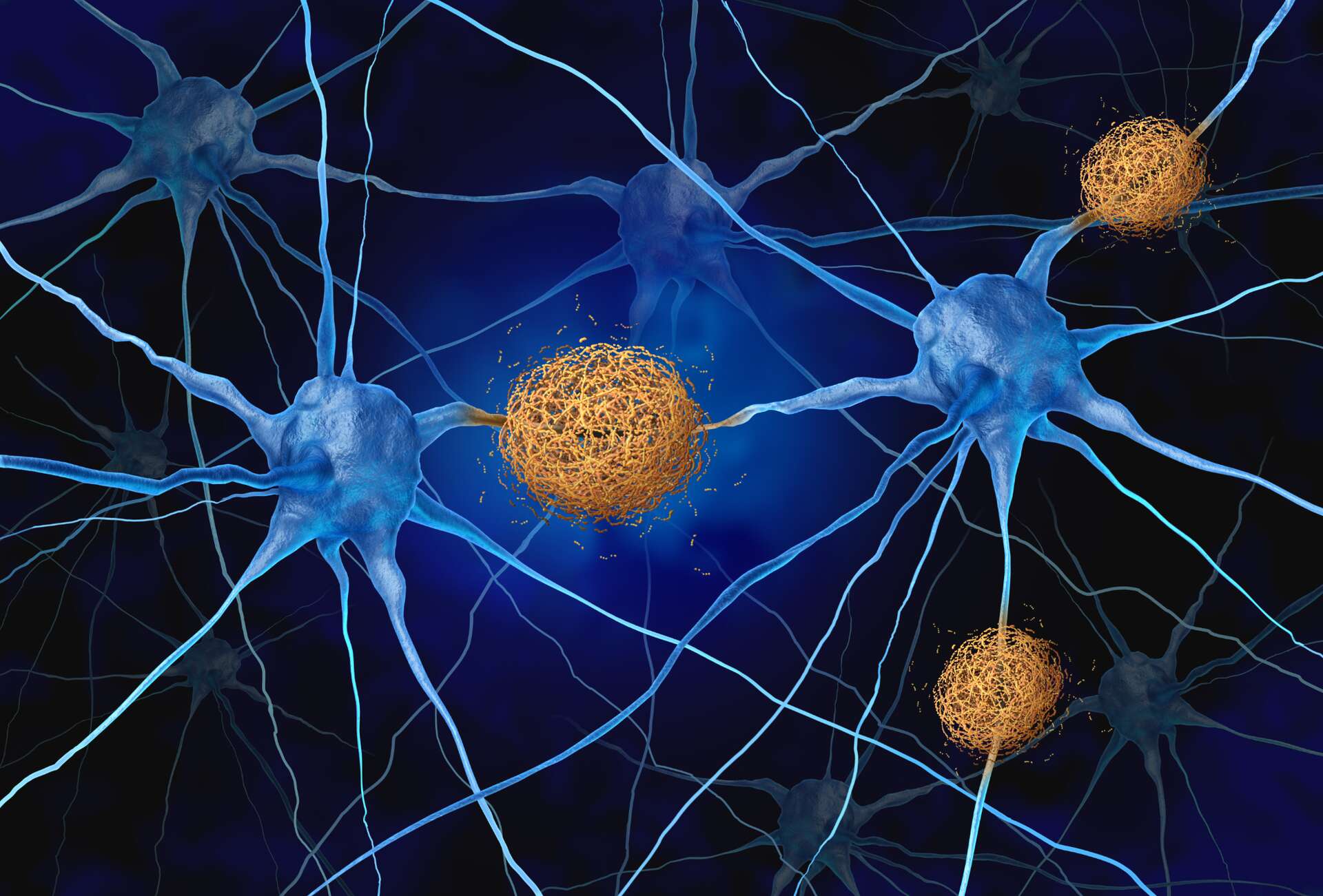 Quand une protéine d’Alzheimer révèle un pouvoir secret capable d’aider à vaincre le cancer