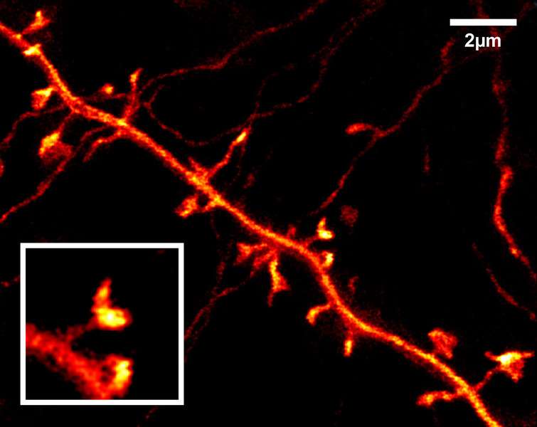 Sur ces neurones de souris, on voit bien les multiples épines dendritiques observées par microscopie Sted. © Max Planck Institute for Biophysical Chemistry