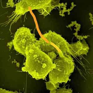 © Max Planck InstituteMacrophages infectés par Bacillus anthracis