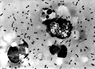 Selon les chercheurs, le germe responsable de la pandémie du Moyen Âge serait l'ancêtre de toutes les formes actuelles de peste. ©AFP Photo/CDC