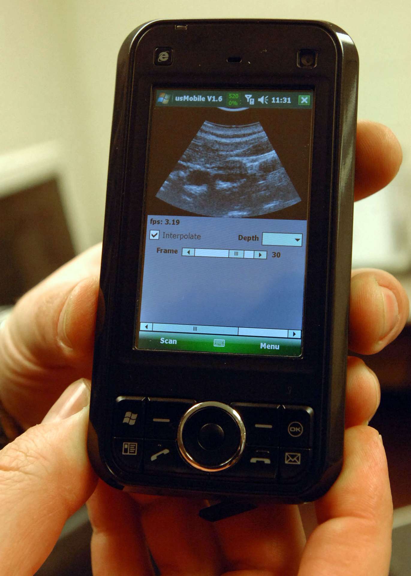 L'image de la carotide de David Zar visualisée sur son téléphone connecté par USB à l'appareil à ultrasons. © David Kilper/WUSTL Photo