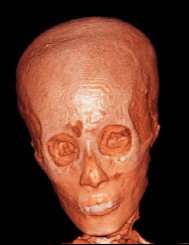 Toutankhamon, comme on ne l'avait encore jamais vu… Mais on savait déjà qu'il ressemblait beaucoup à Tiyi, femme d'Aménophis III, qui serait donc sa grand-mère. A moins que Tiyi n'ait fauté avec son propre fils, Amenophis IV, dit Akhenaton…Copyright