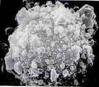Virus du SIDA au microscope (crédit : www.cafeduweb.com)