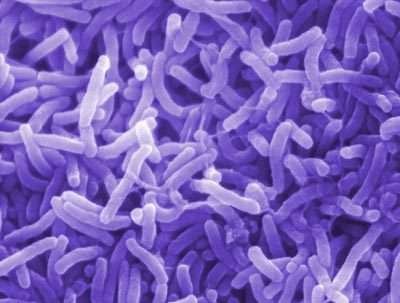 Cholera : comment un parasite rend une bactérie pathogène ?