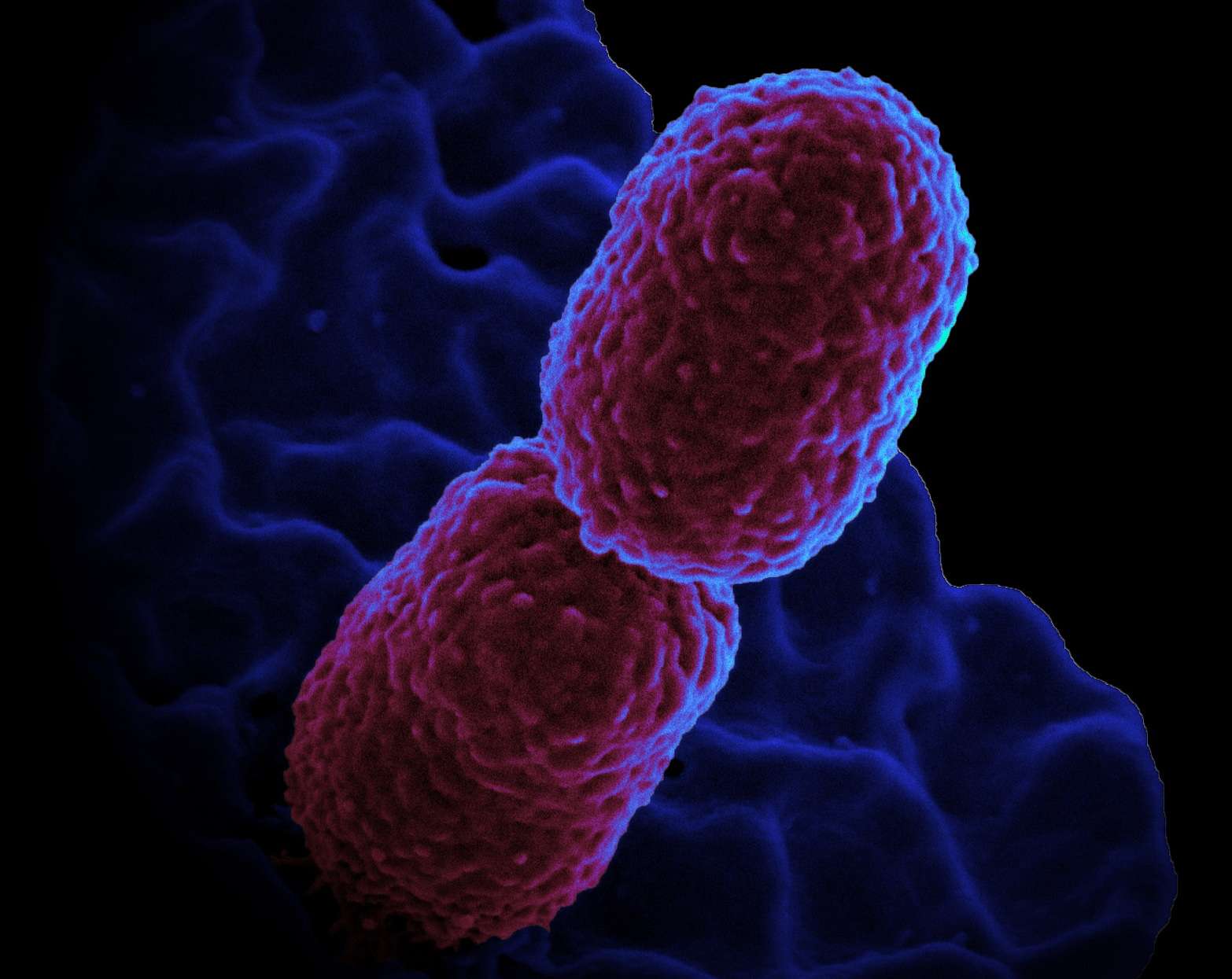 Bacterii klebsiella, Klebsiella pneumoniae-Anticorpi IgG, IgM, IgA | Synevo