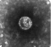 Image en microscopie électronique du virus du Nil occidental.