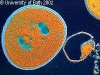 Comment lutter contre le staphylocoque résistant aux antibiotiques ? Comment lutter contre le staphylocoque résistant aux antibiotiques ?