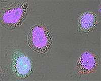 Vers une thérapie génique du traitement du cancer de la prostate Capsides de Baculovirus dans des cellules de cancer prostatique en culture