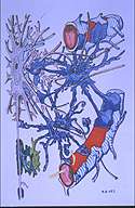 Efficacité des statines pour le traitement de la sclérose en plaques ? Crédits : INSERM 97.La sclérose en plaques détruit à la fois la gaine de myéline (en vert) entourant les fibres nerveuses des neurones (en gris) et les cellules gliales (en bleu) dont les pieds isolent les vaisseaux sang