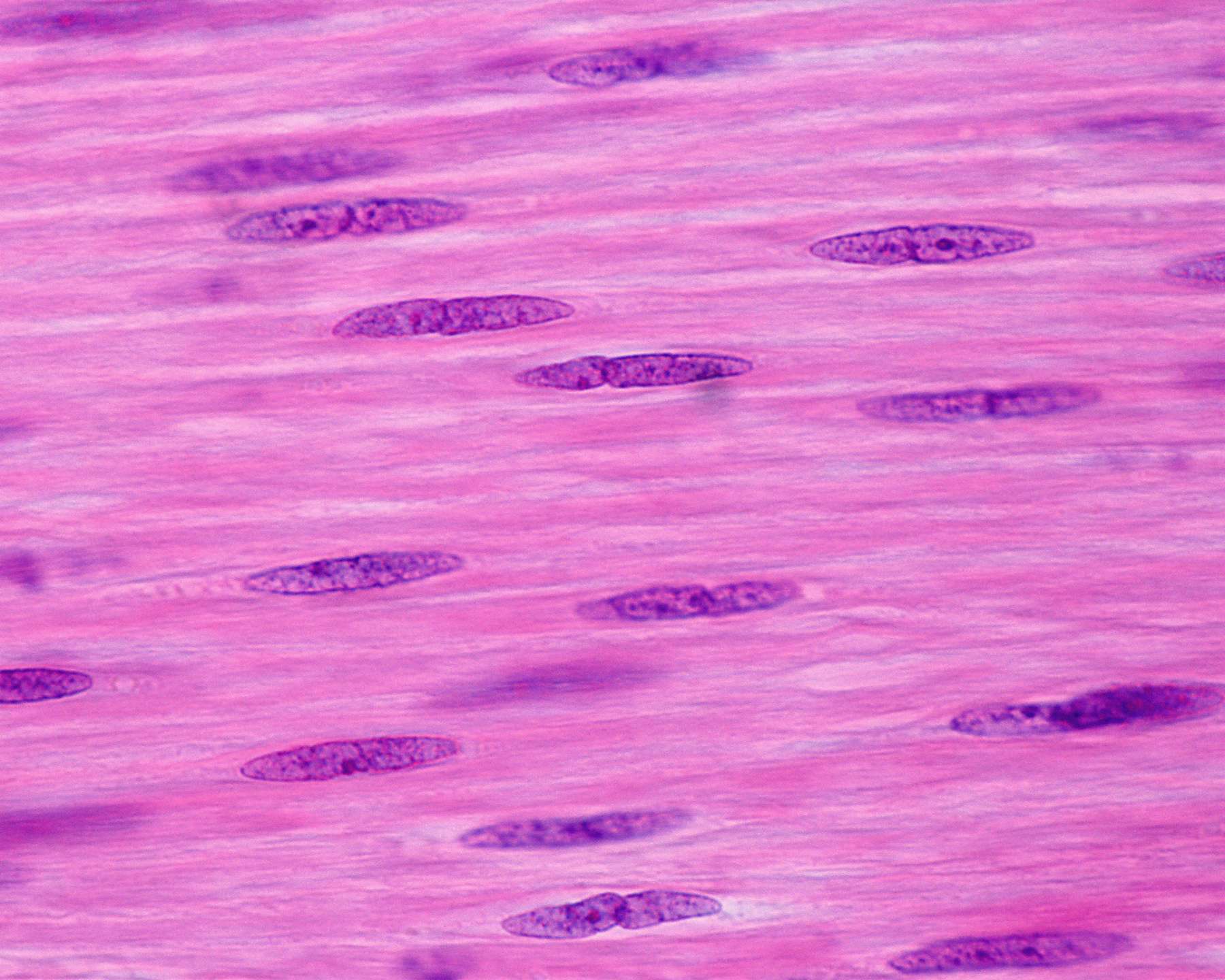 Сильно вытянутые клетки. Веретеновидные клетки. Гладкие мышцы под микроскопом. Клетки исчерченные. Короткие веретеновидные клетки.