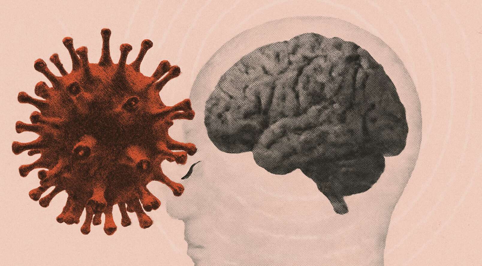 Ces virus courants pourraient favoriser Alzheimer ou Parkinson, révèle une étude sur 500 000 cerveaux