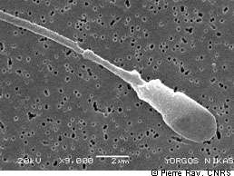 La globozoocéphalie spermatique est caractérisée par la présence d'une tête ronde chez les spermatozoïdes. © Pierre Ray, CNRS