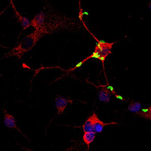 En vert, les protozoaires parasites de la toxoplasmose installés sur des neurones (rouges) cultivées in vitro. Le noyau de ces cellules nerveuses a été coloré en bleu. © I-Ping-Lee/Standford University
