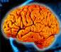 Du nouveau sur l'hyperactivité Crédits : INSERM 80.LE CERVEAU HUMAIN (SYSTEME NERVEUX CENTRAL).