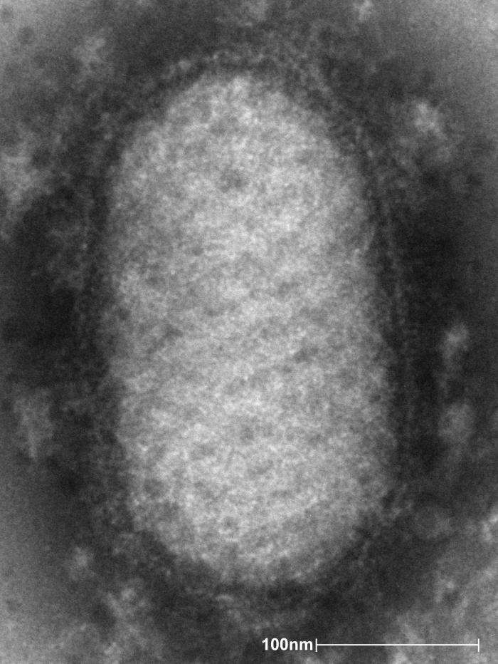 Définition | Poxvirus