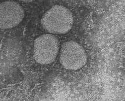 Image en microscopie électronique du nouveau coronavirus causant la pneumonie atypique (crédit : Department of Microbiology, The University of Hong Kong and the Government Virus Unit, Department of Health, Hong Kong SAR China)