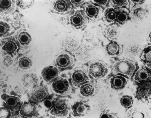 La multiplication du virus de l'herpès, vu ici au microscope électronique, peut être inhibée grâce à l'augmentation du microARN miR-199a-3p dans la cellule. Crédits DR.