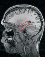 Un gène de la bêtise a-t-il été identifié ? L'hippocampe est une structure du cerveau (encadrée en rouge) impliquée dans la mémorisation des souvenirs. © Eleanor Maguire