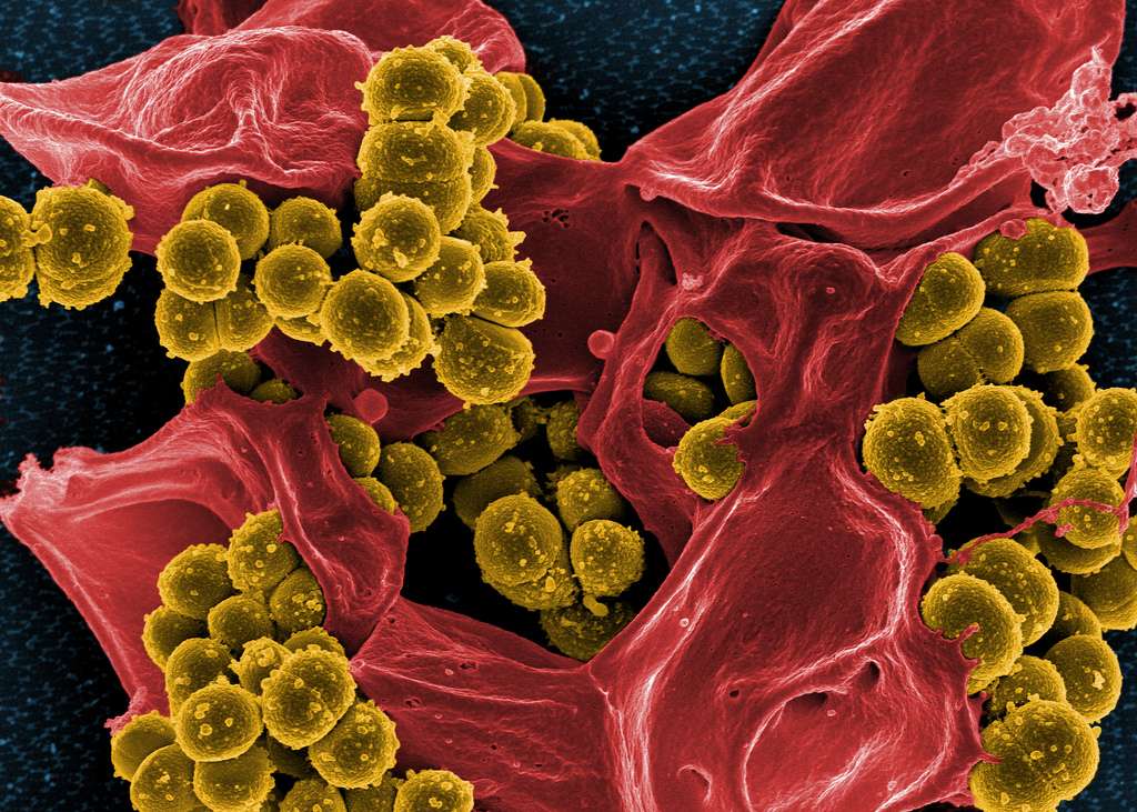 Le staphylocoque doré est de plus en plus résistant aux antibiotiques. On peut en apercevoir ici quelques représentants (en jaune), accompagnés d’un neutrophile mort (en rouge). Comprendre comment cette bactérie infecte les cellules est indispensable pour mettre en place des traitements alternatifs aux antibiotiques. © NIAID, Flickr, cc by 2.0