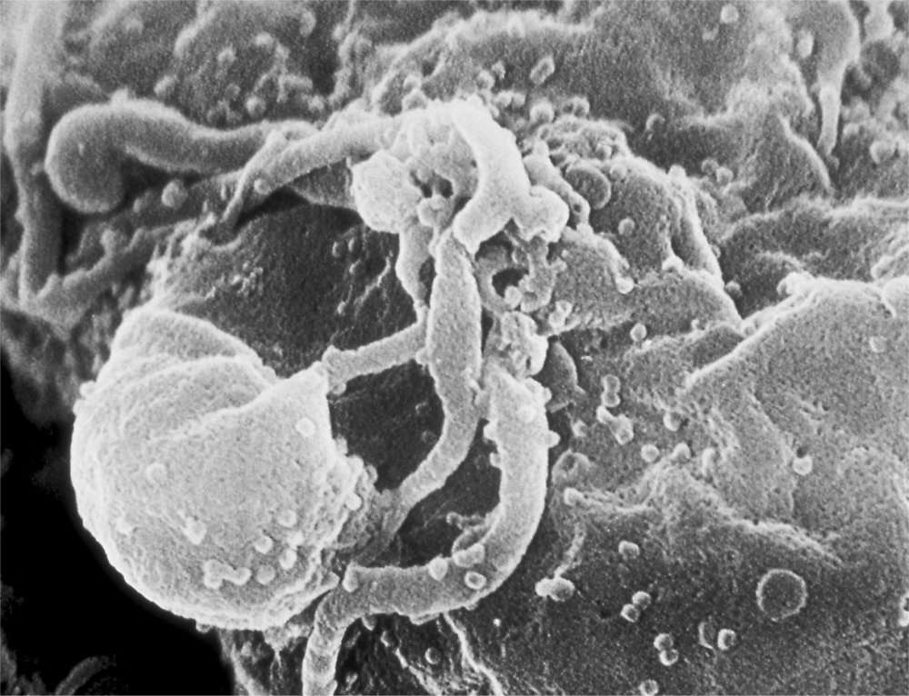 Un virion de HIV en construction (on parle de bourgeonnement) à la surface d'un lymphocyte infecté, qui s'est mis à fabriquer des virus. © Goldsmith/CDC