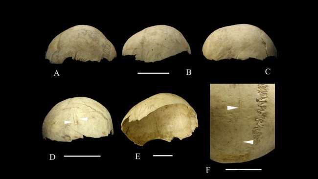 Entre -20.000 et -4.000 ans, les crânes humains signifiaient bien plus que le cannibalisme. Ils seraient la preuve d'un rituel minutieux. © Francesc Marginedas et al., Journal of Archeological Science