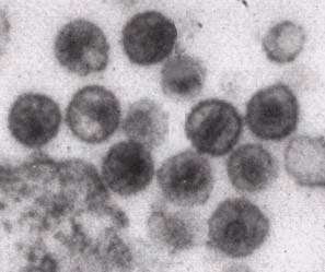 Des virus VIH observés au microscope électronique. © DR